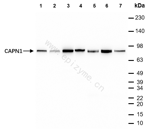 Anti-CAPN1 Mouse mAb [52R99E33]
