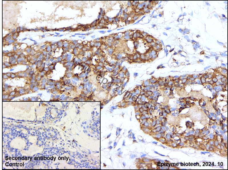 Anti-CAPN1 Mouse mAb [52R99E33]