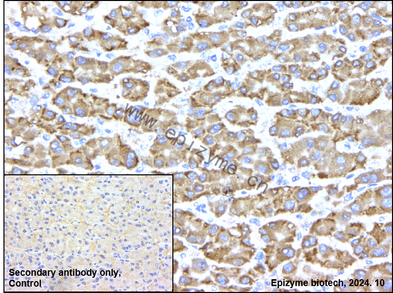 Anti-CAPN1 Mouse mAb [52R99E33]