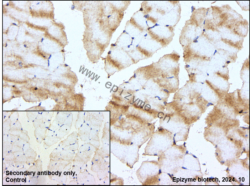 Anti-CAPN1 Mouse mAb [52R99E33]