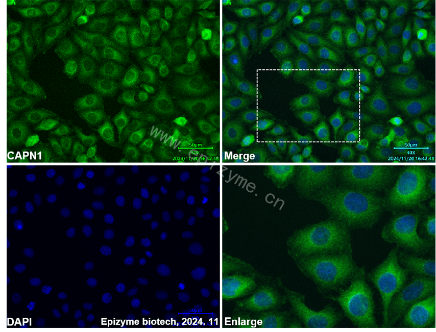 Anti-CAPN1 Mouse mAb [52R99E33]