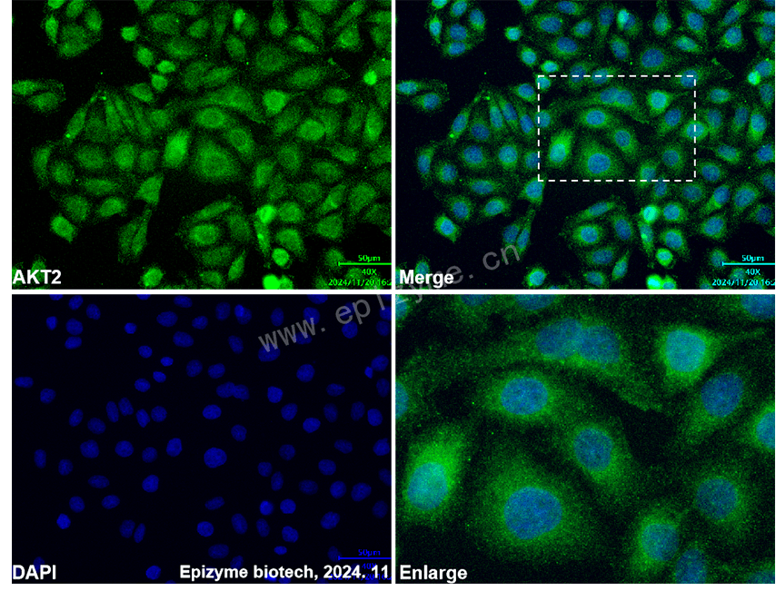 Anti-AKT2 Mouse mAb [62R26K21]