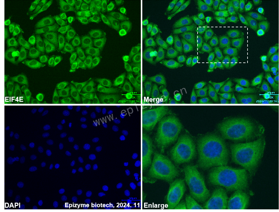 Anti-EIF4E Mouse mAb [36P68F22]