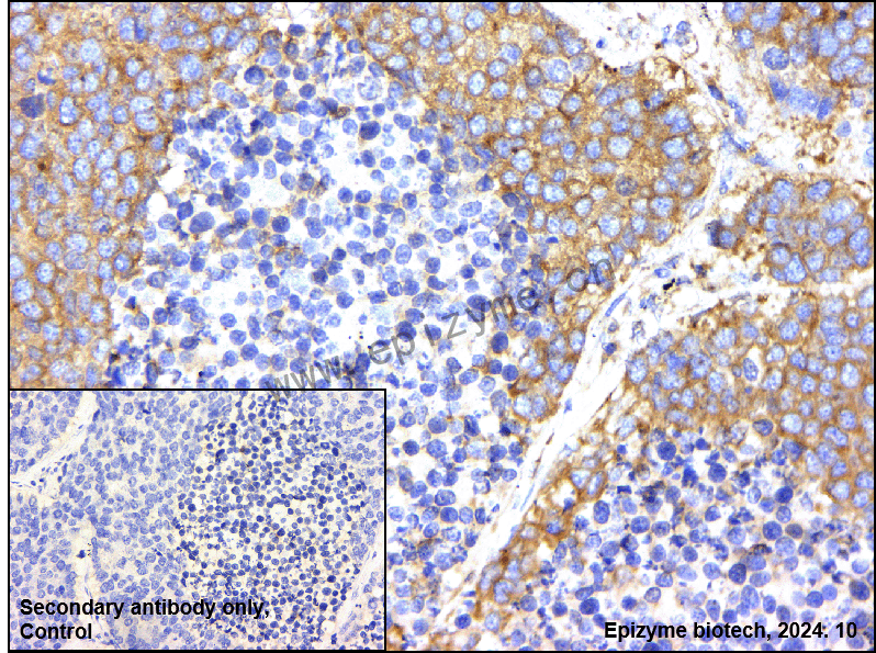 Anti-BRAF Mouse mAb [46I88A93]