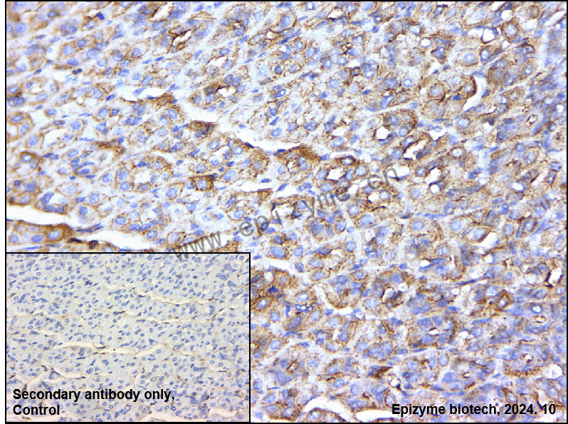 Anti-BRAF Mouse mAb [46I88A93]