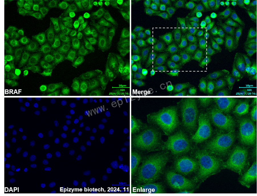 Anti-BRAF Mouse mAb [46I88A93]