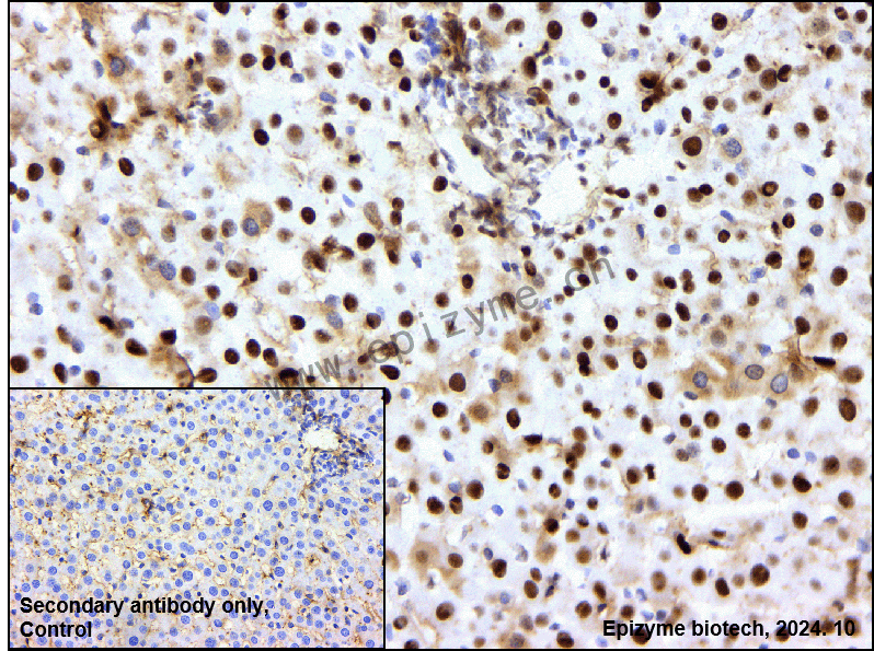 Anti-APEX1 Mouse mAb [79J80D56]