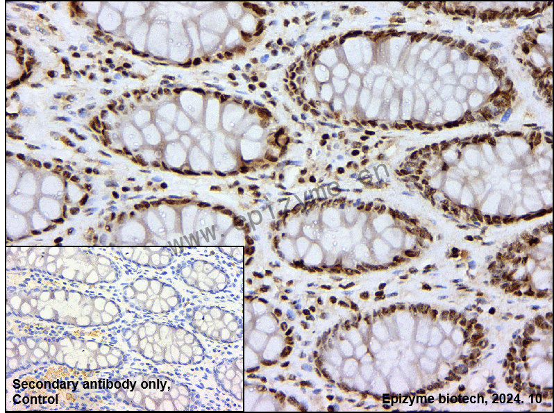 Anti-APEX1 Mouse mAb [79J80D56]
