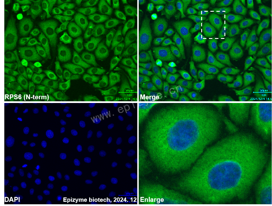 Anti-RPS6 Mouse mAb [24S77F57]