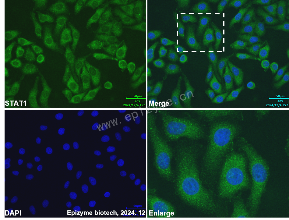 Anti-STAT1 Mouse mAb [37S70S39]