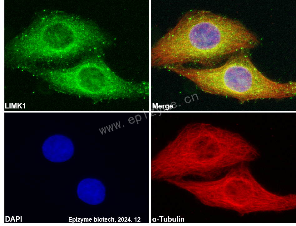 Anti-LIMK1 Mouse mAb [96L52F22]