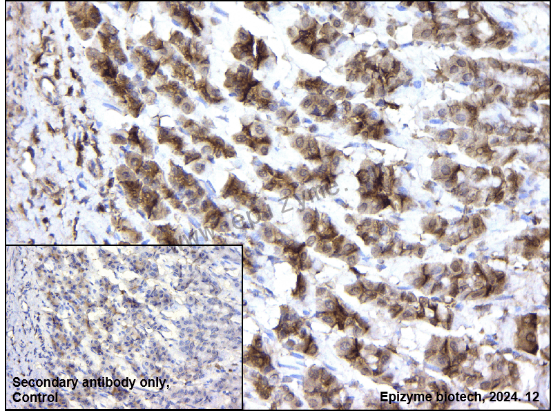 Anti-LIMK1 Mouse mAb [96L52F22]