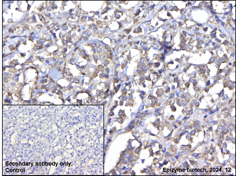 Anti-LIMK1 Mouse mAb [96L52F22]