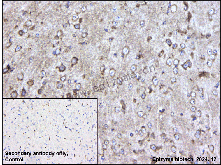Anti-LIMK1 Mouse mAb [96L52F22]