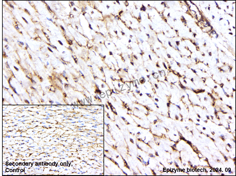 Anti-PPARA Mouse mAb [19I97G56]