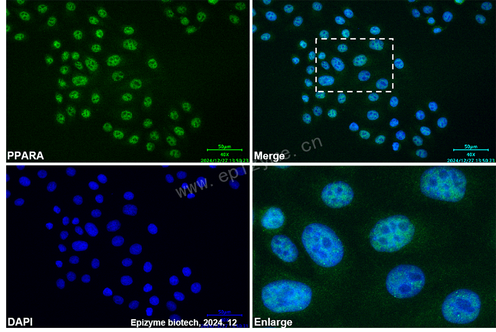 Anti-PPARA Mouse mAb [19I97G56]