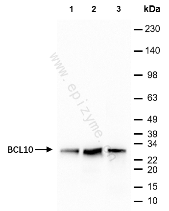Anti-BCL10 Mouse mAb [90A06N20]