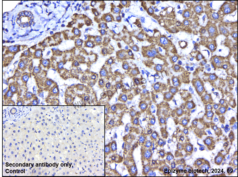 Anti-BCL10 Mouse mAb [90A06N20]