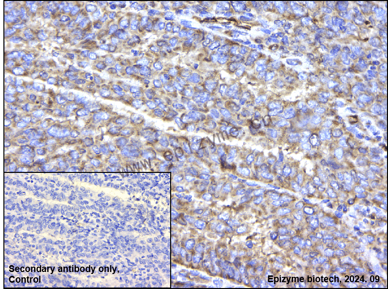 Anti-BCL10 Mouse mAb [90A06N20]