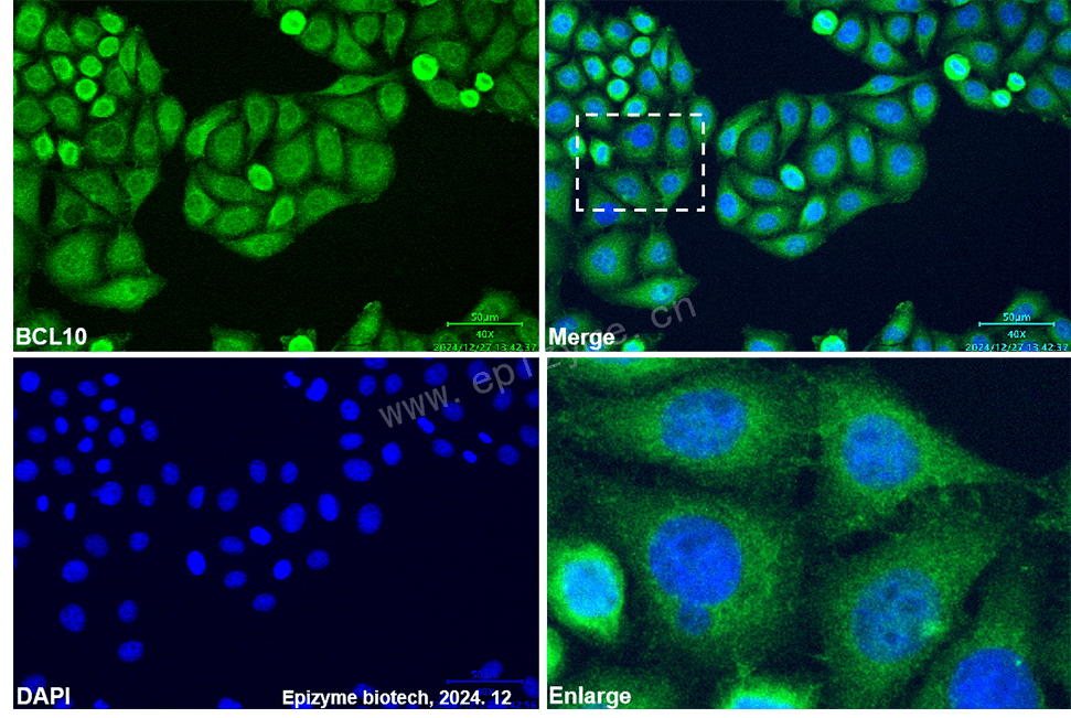 Anti-BCL10 Mouse mAb [90A06N20]