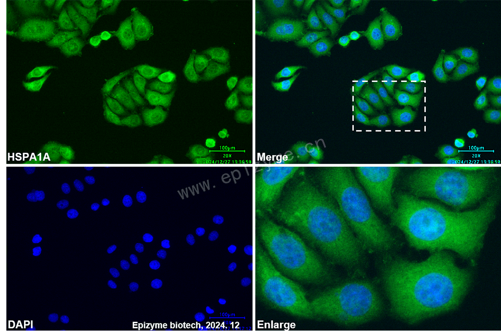Anti-Hsp70 Mouse mAb [72Q64C01]