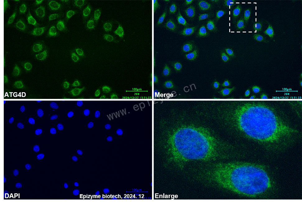 Anti-ATG4D Mouse mAb [74G68S88]