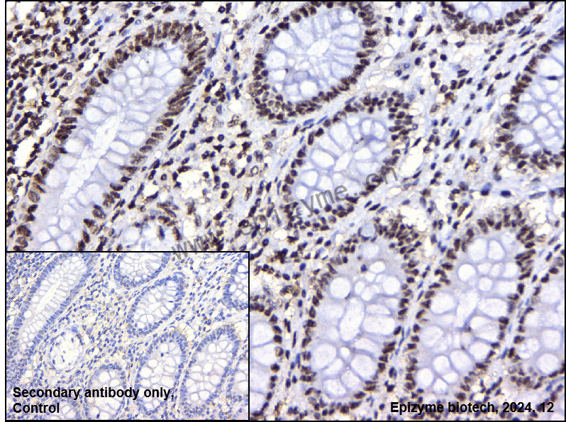 Anti-CREB1 Mouse mAb [12I90N95]