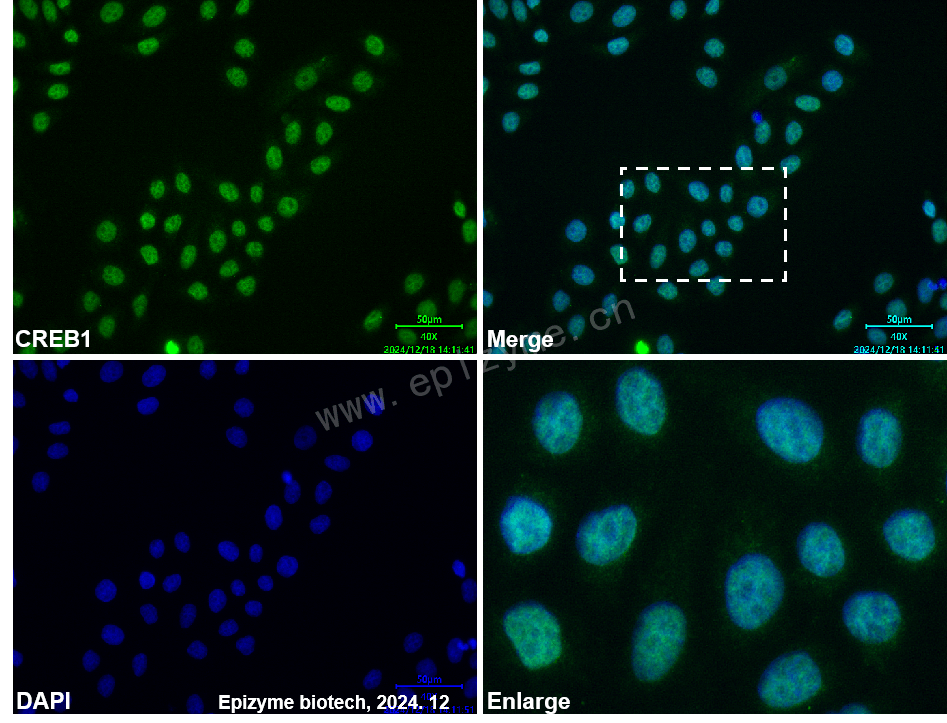 Anti-CREB1 Mouse mAb [12I90N95]