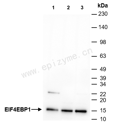 Anti-4E-BP1 Mouse mAb [95H34L20]
