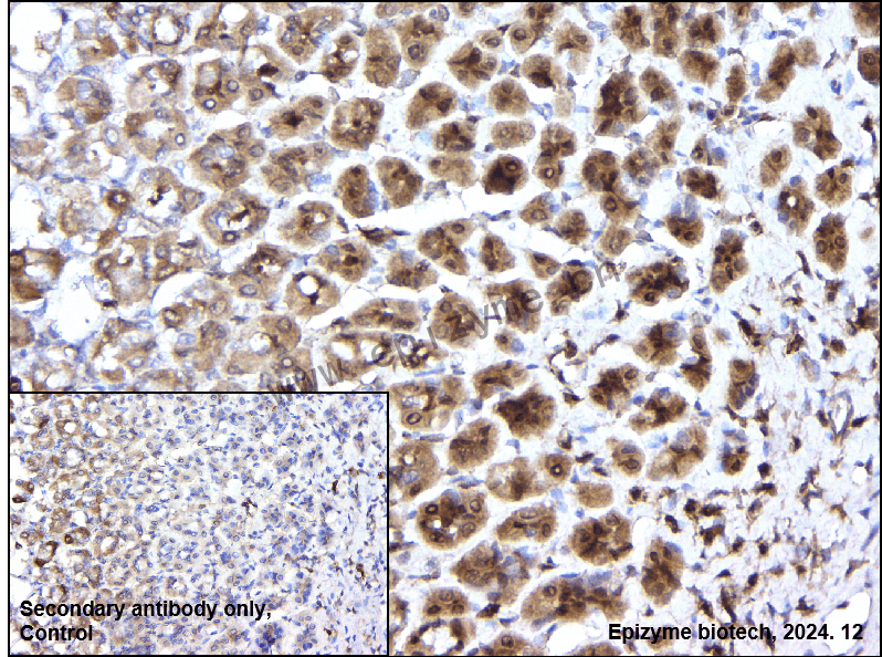 Anti-4E-BP1 Mouse mAb [95H34L20]