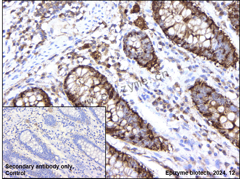 Anti-4E-BP1 Mouse mAb [95H34L20]