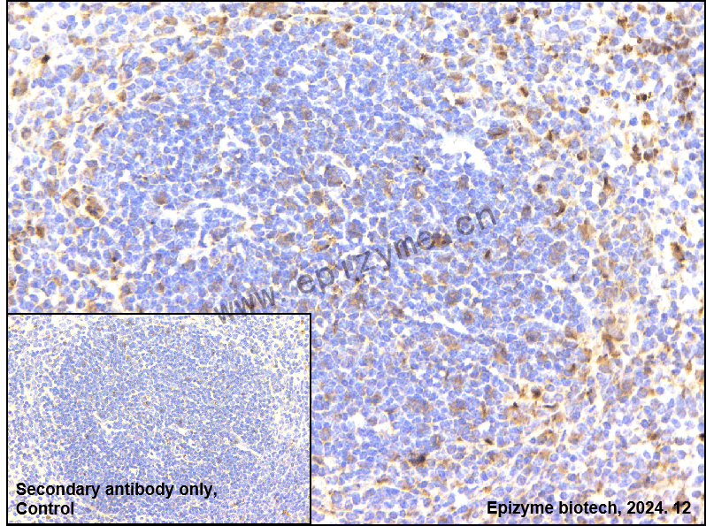 Anti-4E-BP1 Mouse mAb [95H34L20]