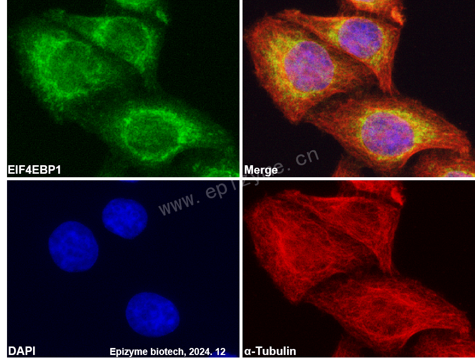 Anti-4E-BP1 Mouse mAb [95H34L20]