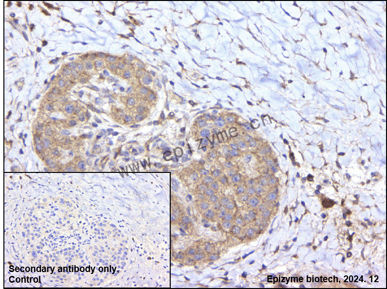 Anti-RAB20 Mouse mAb [35K23D51]