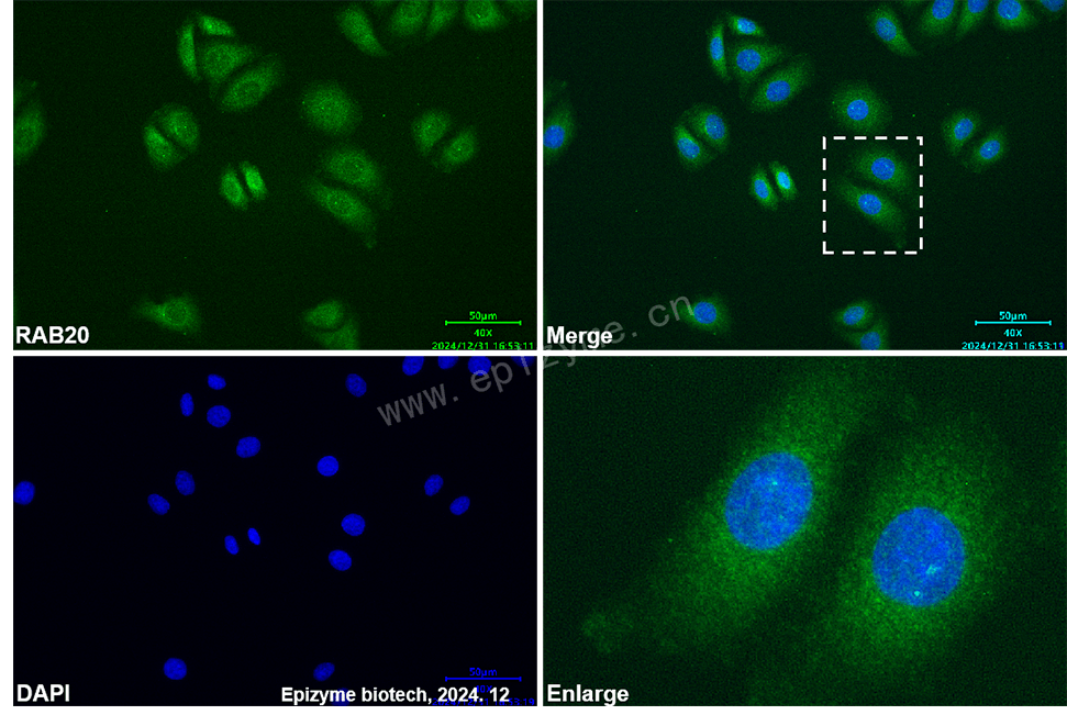 Anti-RAB20 Mouse mAb [35K23D51]