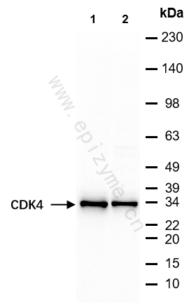 Anti-CDK4 Mouse mAb [41I99E38]
