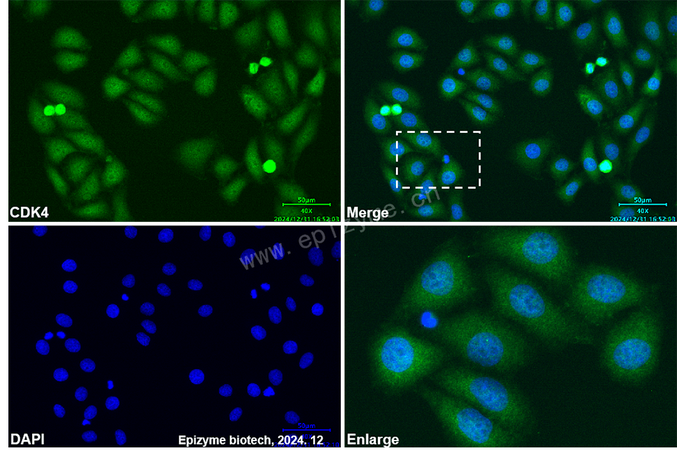 Anti-CDK4 Mouse mAb [41I99E38]