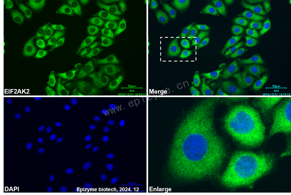 Anti-PKR Mouse mAb [17N88T49]