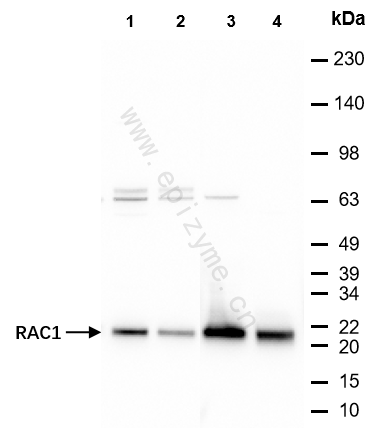 Anti-Rac1 Mouse mAb [34N20L43]