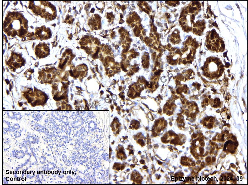 Anti-Rac1 Mouse mAb [34N20L43]