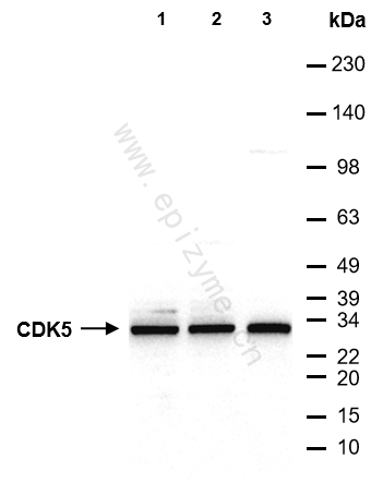 Anti-CDK5 Mouse mAb [73F62B37]
