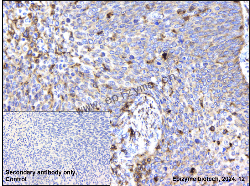 Anti-ATG5 Mouse mAb [66T71M49]