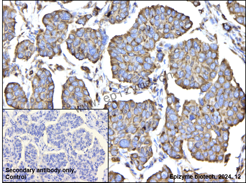 Anti-ATG5 Mouse mAb [66T71M49]