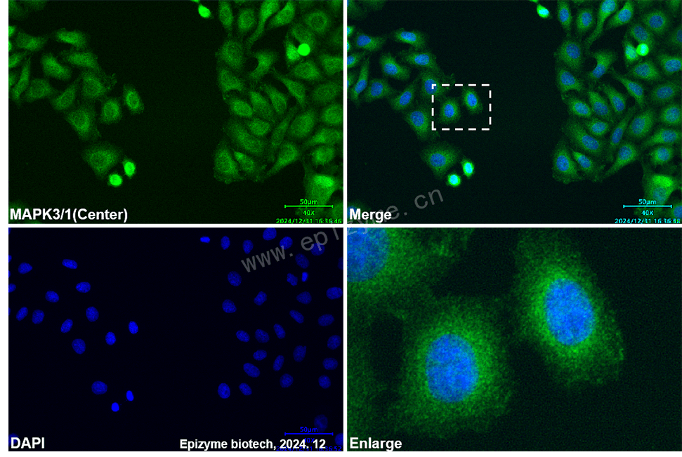 Anti-ERK1/2 Mouse mAb [72P52T83]