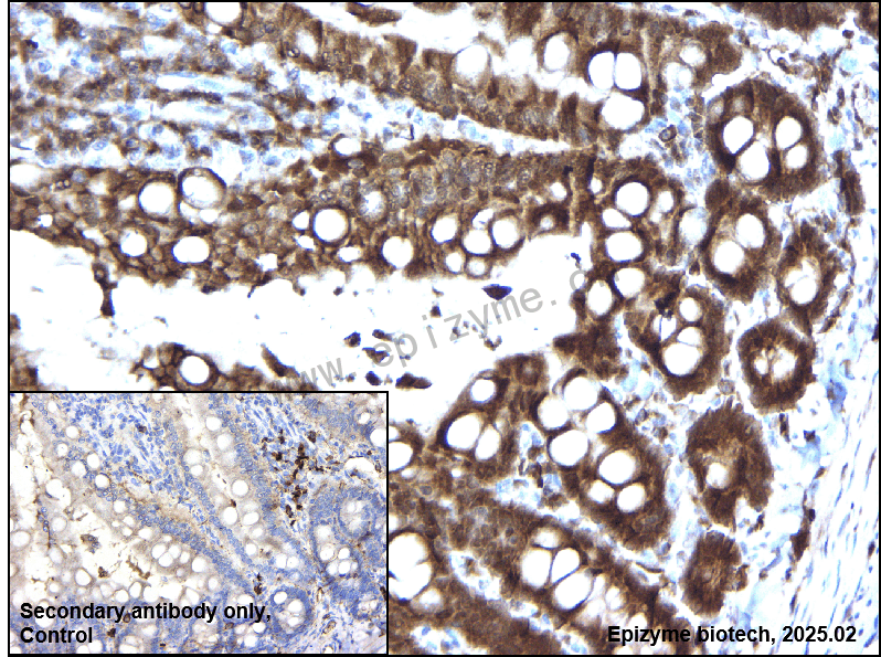 Anti-ERK1/2 Mouse mAb [72P52T83]