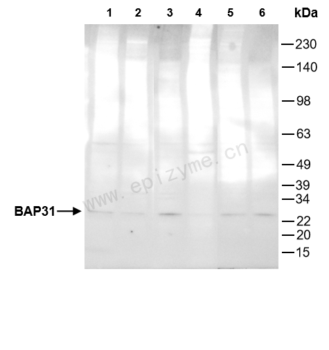 Anti-BAP31 Mouse mAb [53K60A84]