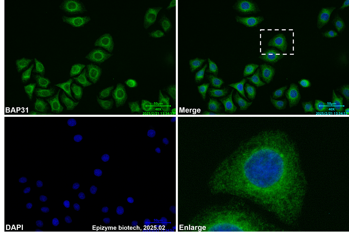 Anti-BAP31 Mouse mAb [53K60A84]
