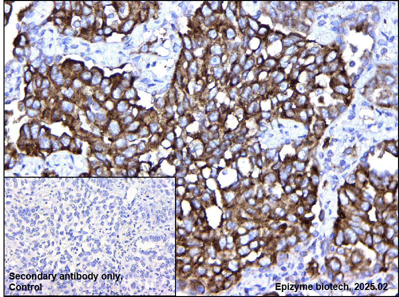 Anti-BAP31 Mouse mAb [53K60A84]