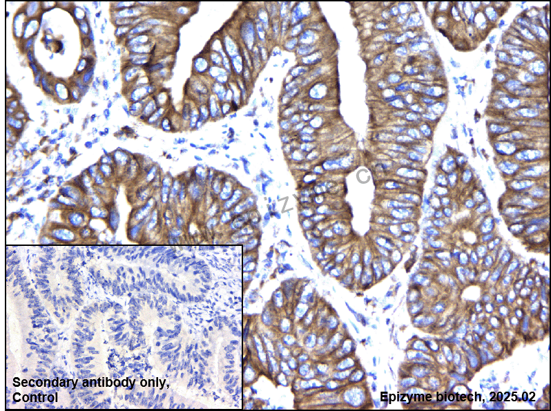 Anti-BAP31 Mouse mAb [53K60A84]