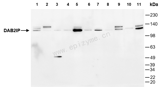 Anti-DAB2IP Mouse mAb [26K84L57]